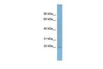 TASP1 Antibody in Western Blot (WB)