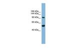 MAP7D1 Antibody in Western Blot (WB)