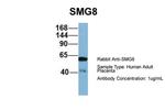 C17orf71 Antibody in Western Blot (WB)