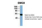 C17orf71 Antibody in Western Blot (WB)