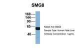 C17orf71 Antibody in Western Blot (WB)