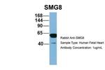 C17orf71 Antibody in Western Blot (WB)