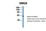 C17orf71 Antibody in Western Blot (WB)