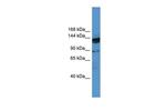 OGDHL Antibody in Western Blot (WB)