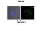 RAB22A Antibody in Immunocytochemistry (ICC/IF)