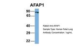 AFAP Antibody in Western Blot (WB)