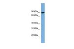 AFAP Antibody in Western Blot (WB)