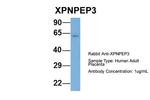 XPNPEP3 Antibody in Western Blot (WB)