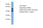 Spastin Antibody in Western Blot (WB)