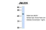 JMJD5 Antibody in Western Blot (WB)