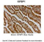 IGF2BP1 Antibody in Immunohistochemistry (IHC)