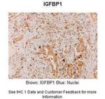 IGF2BP1 Antibody in Immunohistochemistry (IHC)