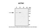 alpha Actinin 1 Antibody in Western Blot (WB)