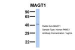 MAGT1 Antibody in Western Blot (WB)