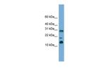 PEA15 Antibody in Western Blot (WB)