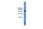 USP15 Antibody in Western Blot (WB)