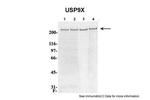 USP9X Antibody in Western Blot (WB)