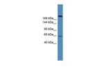 USP9X Antibody in Western Blot (WB)