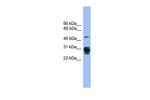 PSMD9 Antibody in Western Blot (WB)