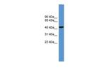 Synaptotagmin 5 Antibody in Western Blot (WB)