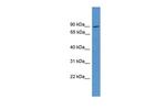 NCKIPSD Antibody in Western Blot (WB)