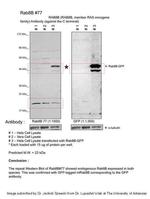 RAB8B Antibody in Western Blot (WB)