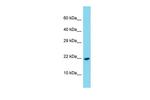 PDGF-C Antibody in Western Blot (WB)