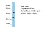 LPGAT1 Antibody in Western Blot (WB)