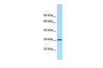 ACY3 Antibody in Western Blot (WB)