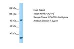 GIGYF2 Antibody in Western Blot (WB)