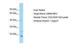 EBNA1BP2 Antibody in Western Blot (WB)