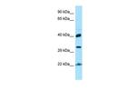 KTI12 Antibody in Western Blot (WB)