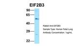 eIF2b gamma Antibody in Western Blot (WB)