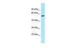 eIF2b gamma Antibody in Western Blot (WB)