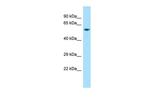 D2HGDH Antibody in Western Blot (WB)