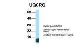 UQCRQ Antibody in Western Blot (WB)