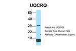 UQCRQ Antibody in Western Blot (WB)