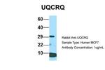 UQCRQ Antibody in Western Blot (WB)