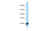 UQCRQ Antibody in Western Blot (WB)