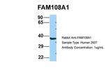 FAM108A1 Antibody in Western Blot (WB)