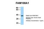 FAM108A1 Antibody in Western Blot (WB)