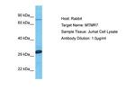 MTMR7 Antibody in Western Blot (WB)