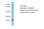 RAB3GAP2 Antibody in Western Blot (WB)