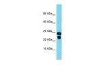 IDNK Antibody in Western Blot (WB)