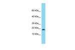 XAGE1 Antibody in Western Blot (WB)