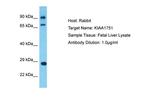 KIAA1751 Antibody in Western Blot (WB)