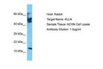 KLLN Antibody in Western Blot (WB)