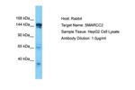 SMARCC2 Antibody in Western Blot (WB)