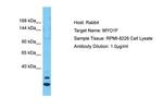 MYO1F Antibody in Western Blot (WB)