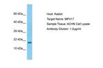 MPV17 Antibody in Western Blot (WB)